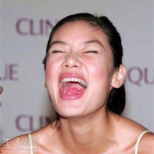 明星网红蛀牙,口腔健康不容忽视